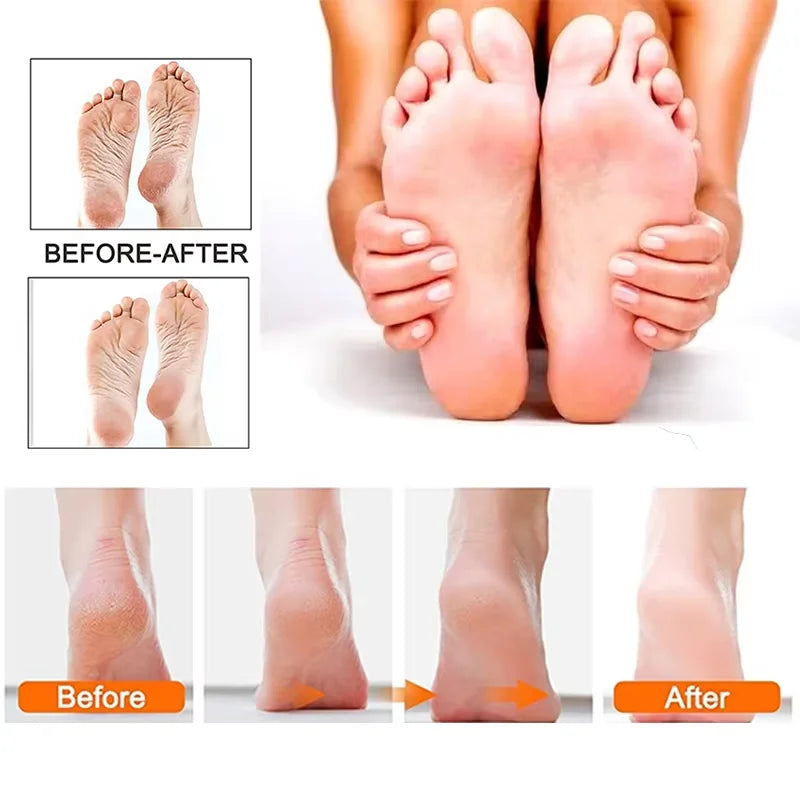 Lixa Elétrica Recarregável para os Pés com 10 Refis
