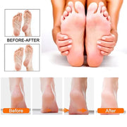 Lixa Elétrica Recarregável para os Pés com 10 Refis